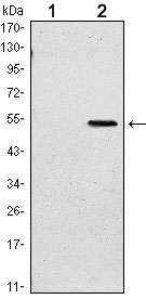 1 - SUZ12 Antibody AO1495a