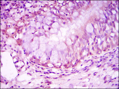 2 - NR3C1 Antibody AO1510a