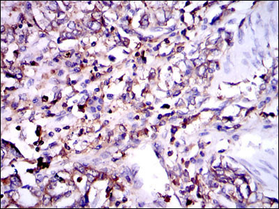 2 - G6PD Antibody AO1634a