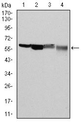 1 - G6PD Antibody AO1634a