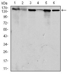 1 - MSH6 Antibody AO1649a