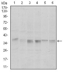 1 - PPP1CA Antibody AO1657a