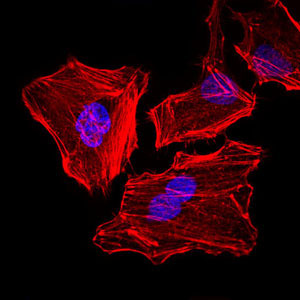 3 - CK5 Antibody AO1699a