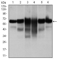 1 - CK5 Antibody AO1699a
