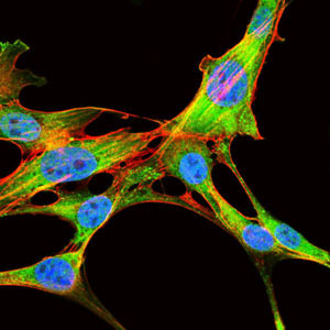 3 - EIF4B Antibody AO1715a