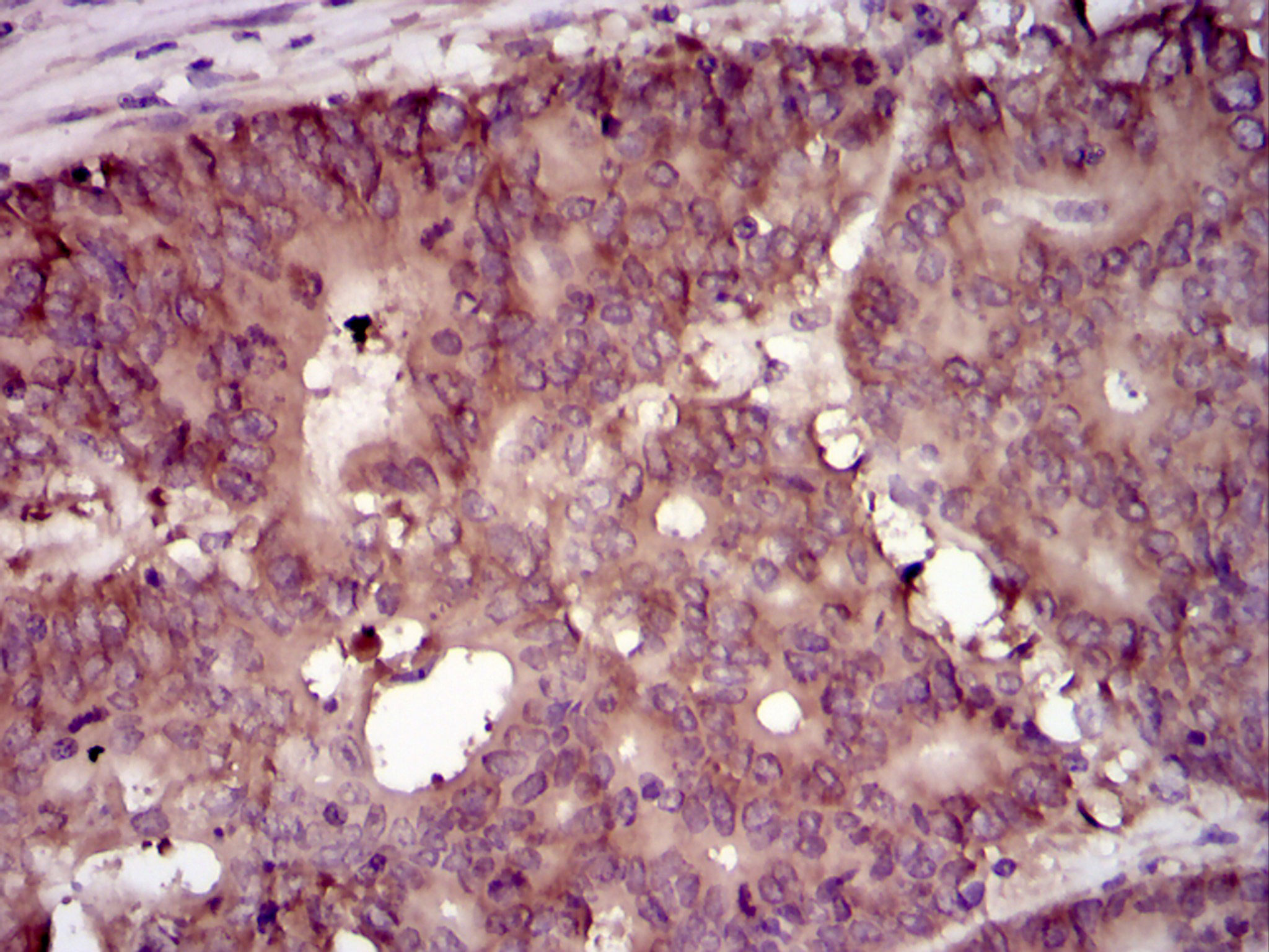 2 - EIF4B Antibody AO1715a