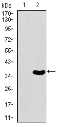 1 - T Antibody AO1777a