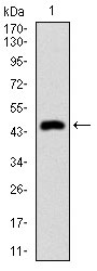 1 - CK5 Antibody AO1801a