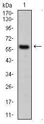 1 - CK5 Antibody AO1844a