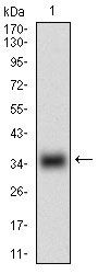1 - MSTN Antibody AO1925a