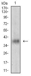 1 - MSTN Antibody AO1925a