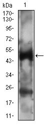 1 - PTPN1 Antibody AO1991a