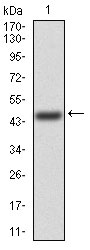 1 - FGFR3 Antibody AO2039a