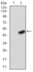 1 - FGFR3 Antibody AO2039a