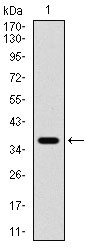 1 - PDPK1 Antibody AO2066a