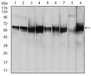 1 - PDPK1 Antibody AO2066a