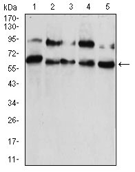 1 - CBX2 Antibody AO2138a