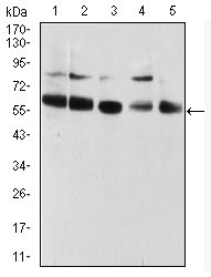 1 - CBX2 Antibody AO2139a