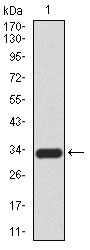 1 - CK5 Antibody AO2150a