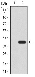 1 - CK5 Antibody AO2150a