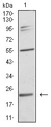 1 - IL28A Antibody AO2197a