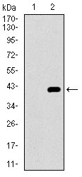 1 - ITGA2B Antibody AO2319a