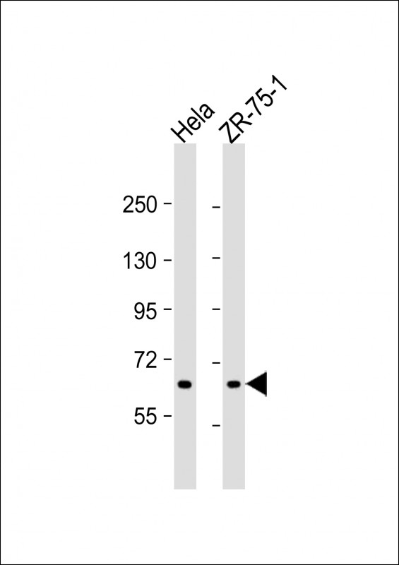 1 - TGM5 Antibody (C-term) AP19201b
