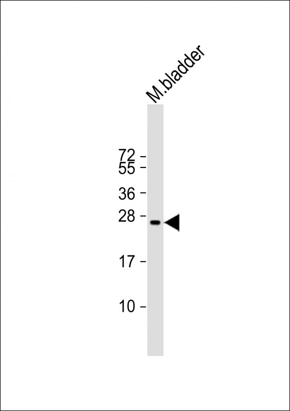1 - Mouse Gsta3 Antibody (C-term) AP19311b