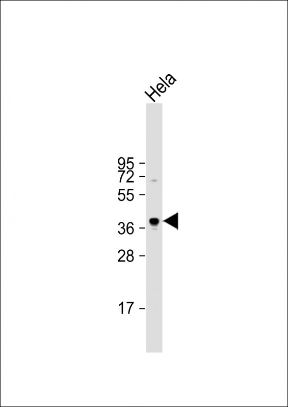 1 - PKA C-alpha/PKA C-beta Antibody (N-term) AP7013a