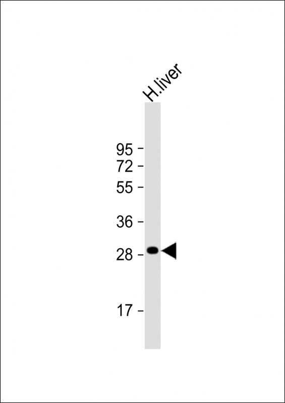 1 - QDPR Antibody (C-term) AP8841b