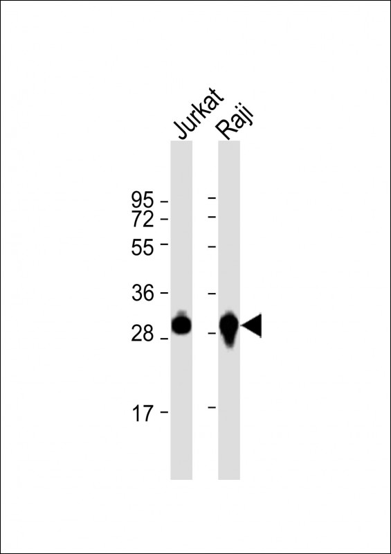 1 - ANP32A Antibody (C-term) AP9520b