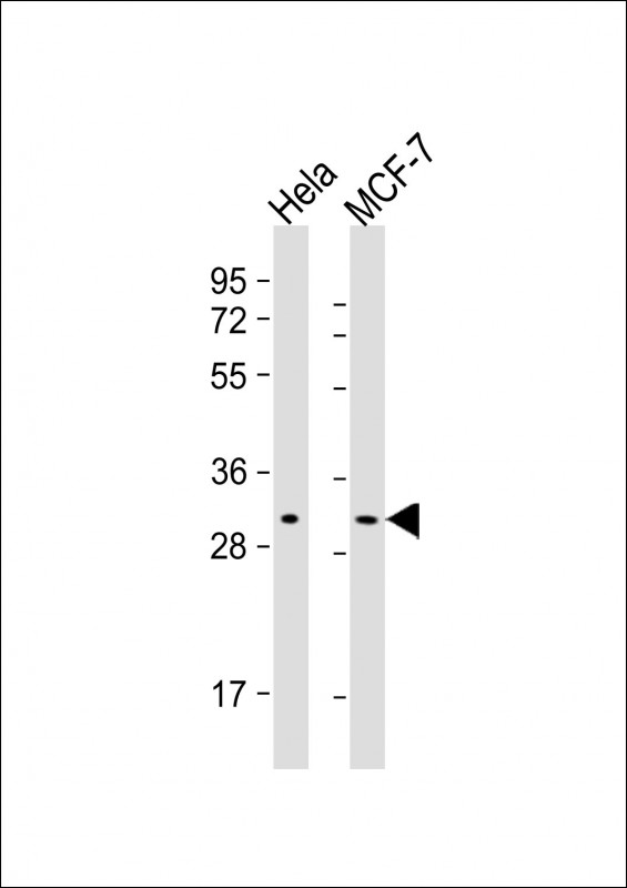 1 - RAB20 Antibody AM8560b