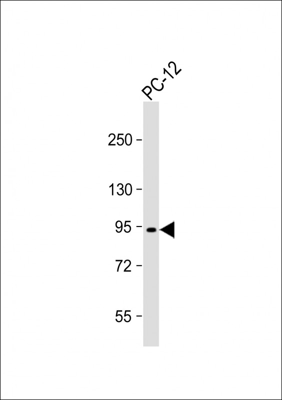 1 - PCSK1 Antibody (N-Term) AP22127a