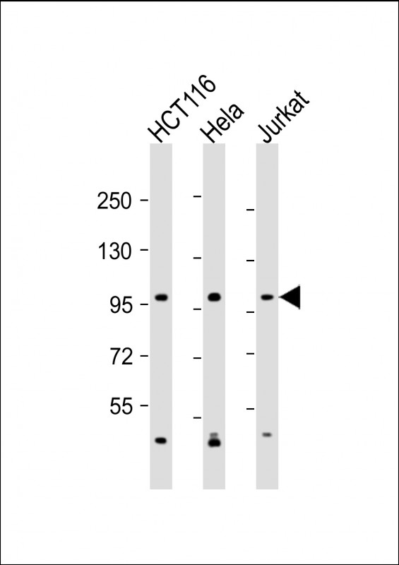 1 - MANBA Antibody (C-Term) AP22130b
