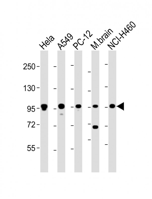 1 - PCSK1 Antibody (C-Term) AP22139b
