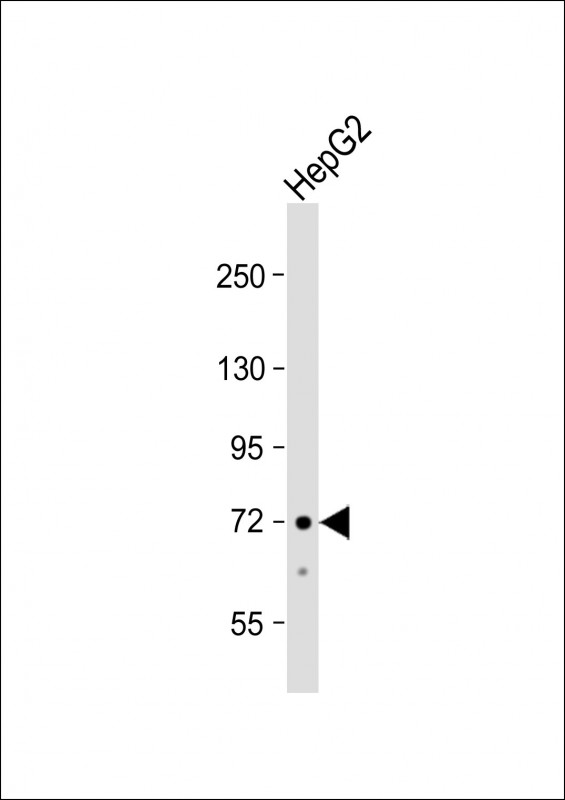 1 - ACSS3 Antibody (Center) AP8579c