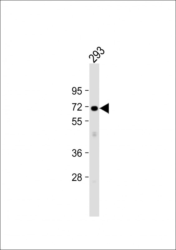 1 - PLCZ1 Antibody (N-term) AP9423a
