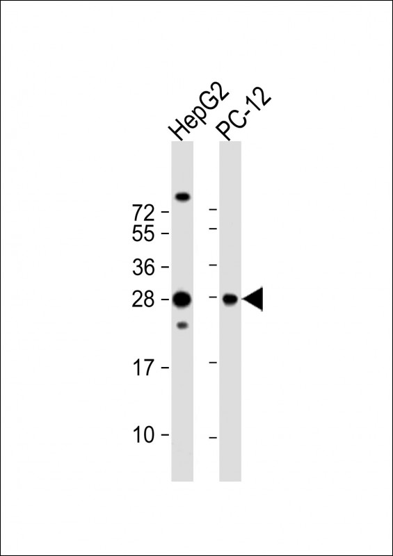 1 - PCMT1 Antibody (N-Term) AP22160a