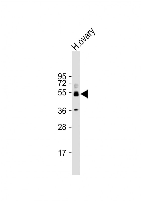 1 - SH3BP5 Antibody (N-Term) AP22165a