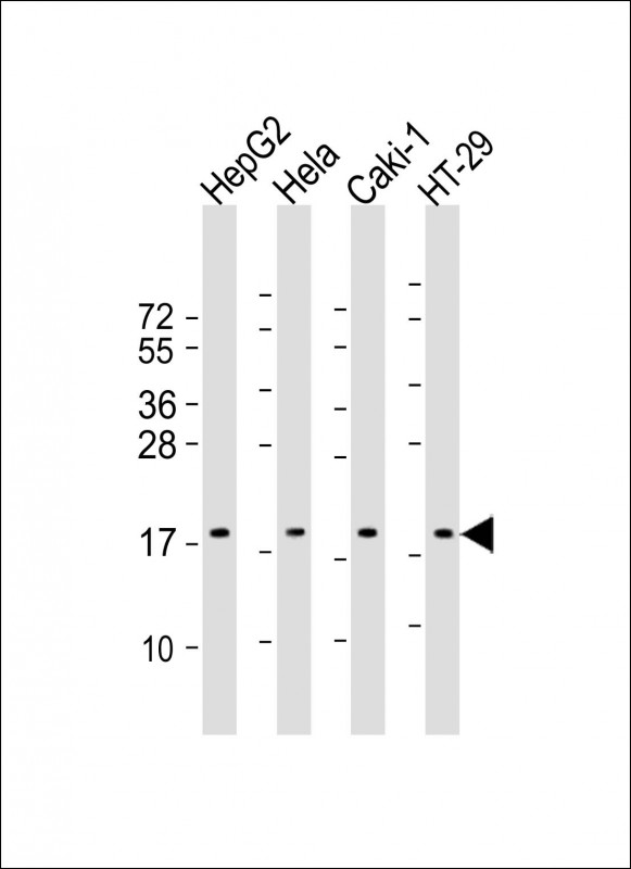 1 - ARF4 Antibody (Center) AP22186c