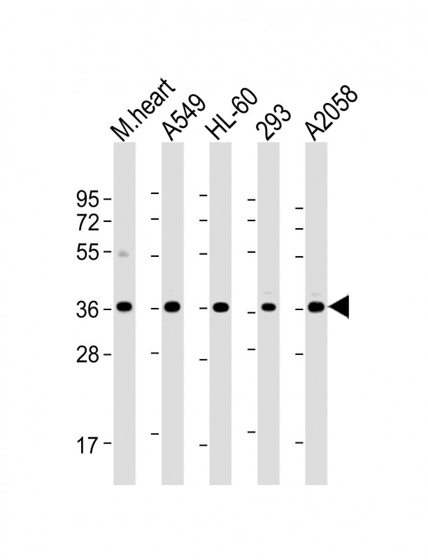 1 - WBP2 Antibody (C-term)[Knockdown Validated] AM8599b