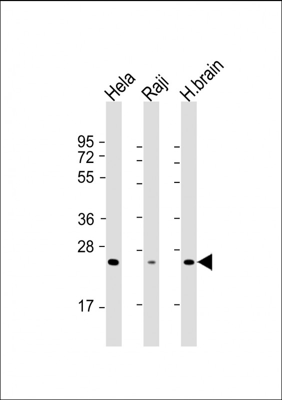 1 - RAB14 Antibody [Knockdown Validated] AM8601b