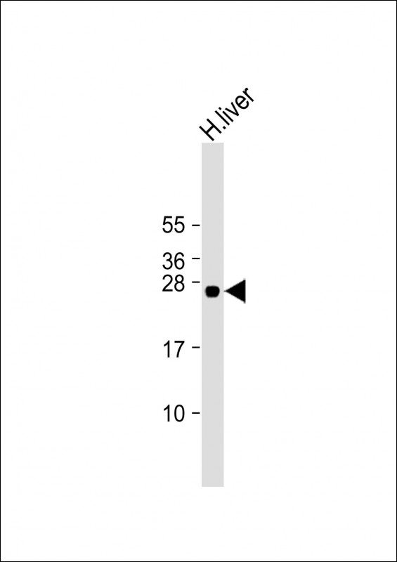 1 - GSTA5 Antibody (Center) AP22214c