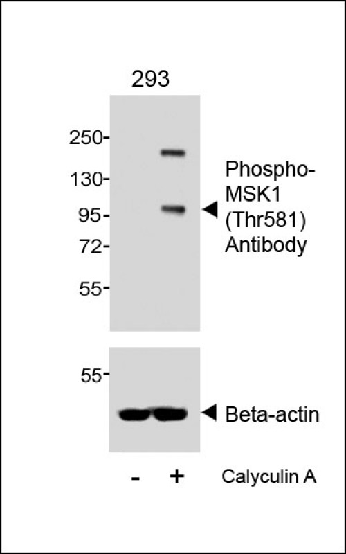1 - Phospho-MSK1 (Thr581) Antibody AP3909a