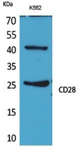 1 - CD28 Polyclonal Antibody  ABV11722
