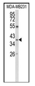 1 - ARG1 Polyclonal Antibody ABV11726