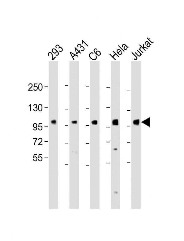 1 - EEF2K (Ser366) Antibody AP22222a