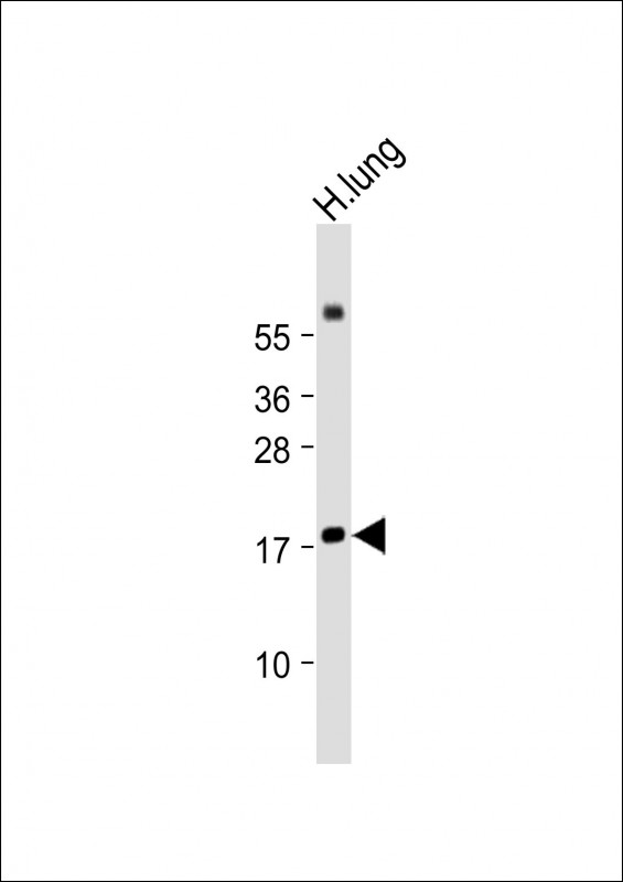 1 - RARRES2 Antibody (Center) AP22233c