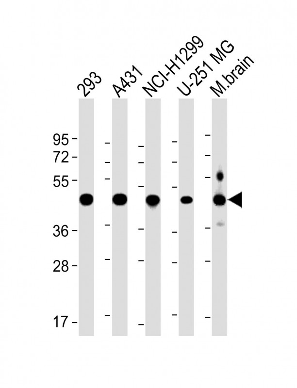 1 - NSFL1C Antibody (Center) AP22236c