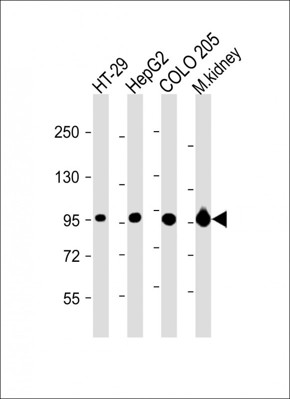 1 - Villin-1 Antibody (N-term) AP6774a